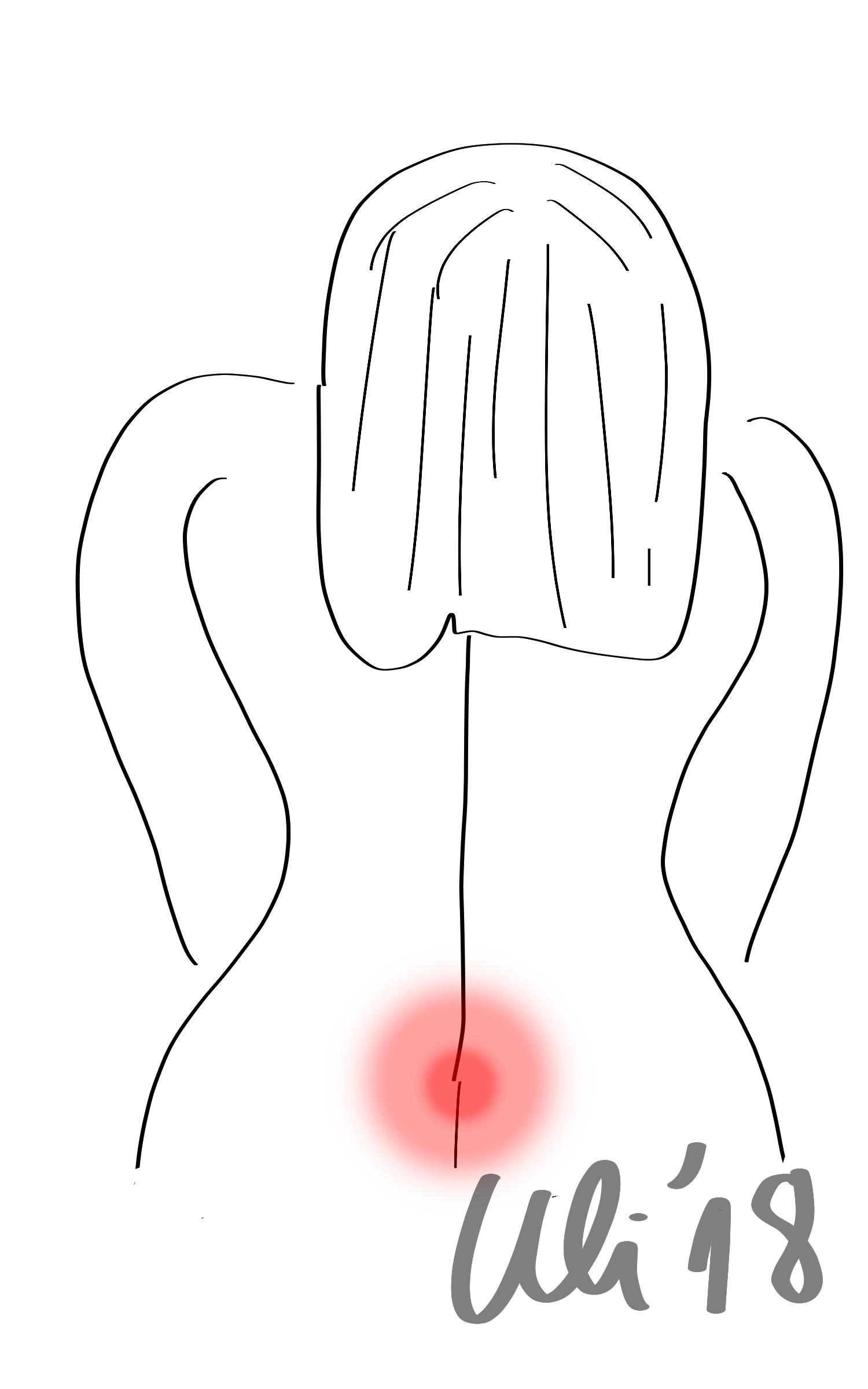 Rückenschmerzen